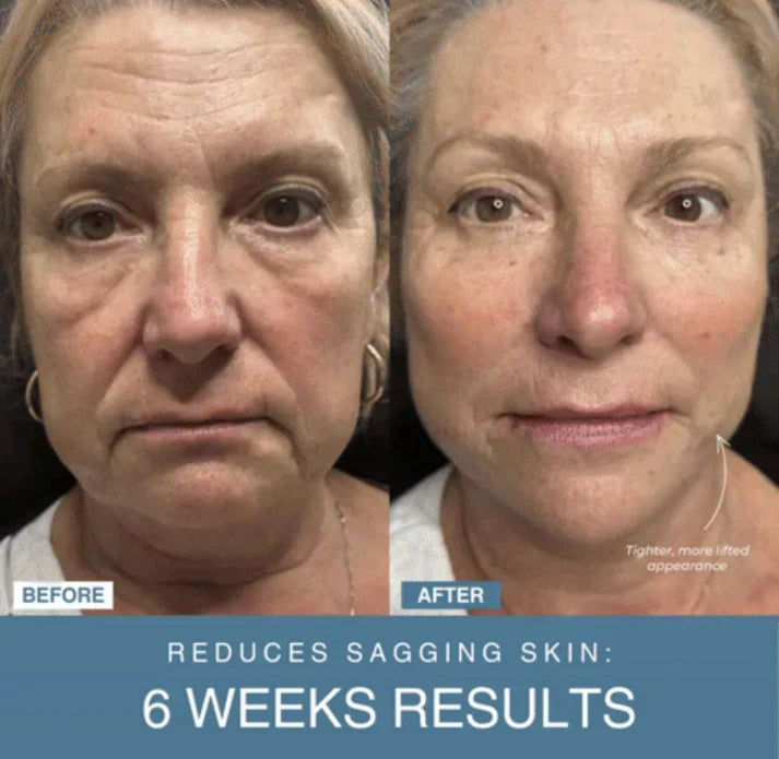 Tijarat™  7-in-1 LED Anti-Aging/Wrinkle Apparatus