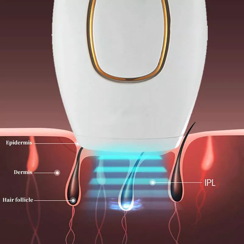 Tijarat™ IPL Laser Hair Removal – جهاز إزالة الشعر بالليزر IPL